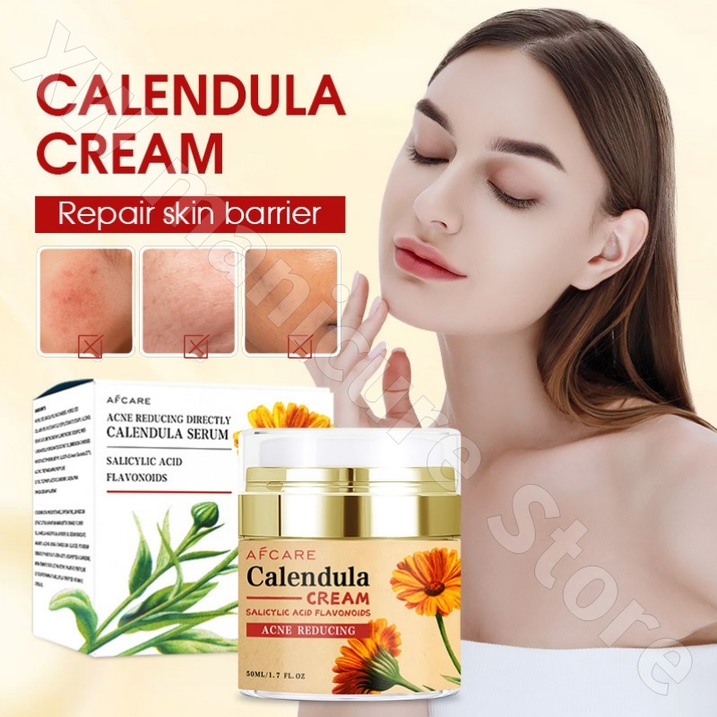 Repairing Calendula Cream Mois – Luxury Skincare Whitening Cream Bewertung und Preis