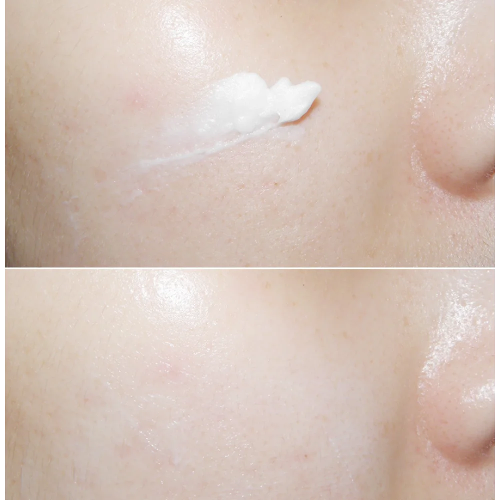 Korea Mizon Skin Recovery Nigh – Luxury Skincare In Korea Bewertung und Preis