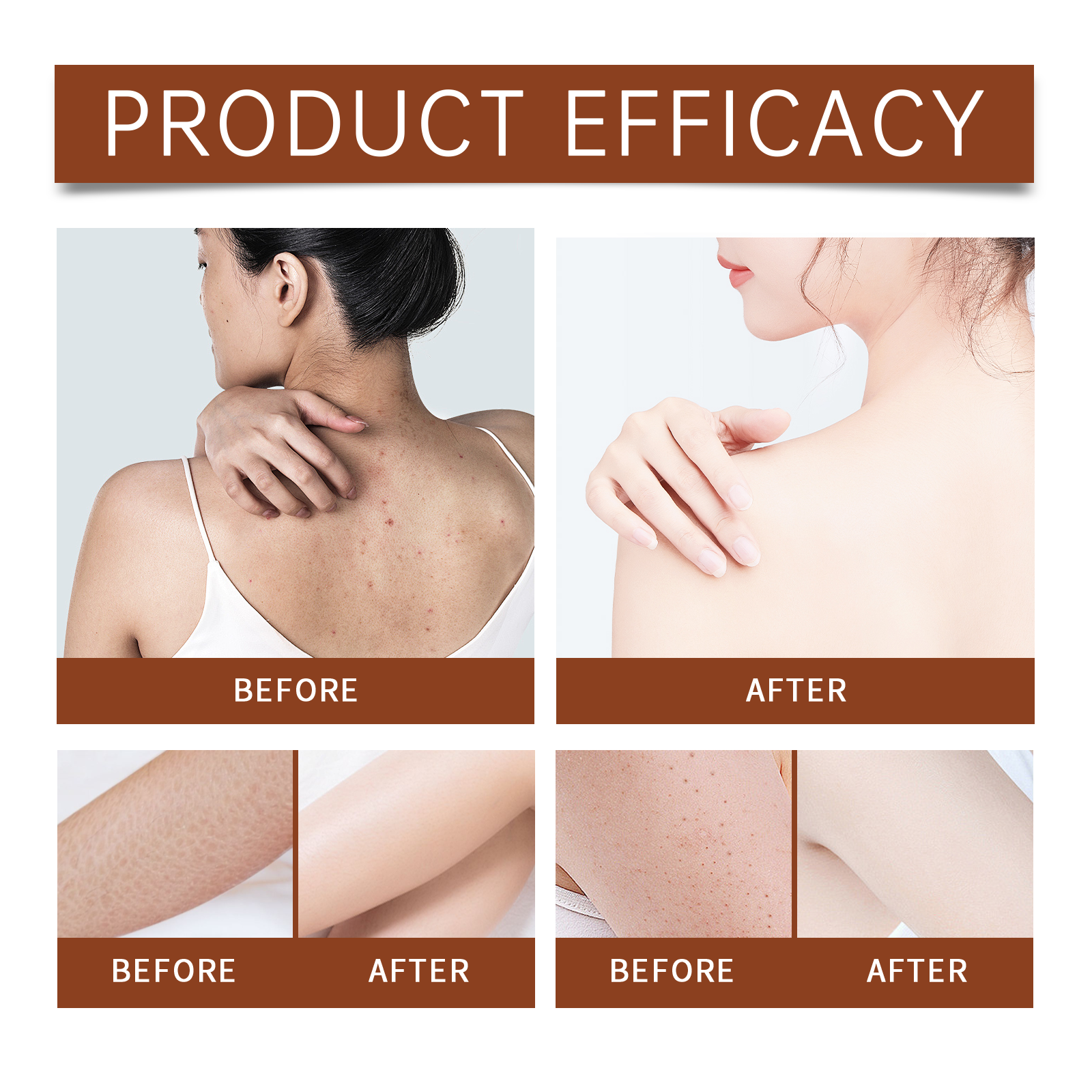 Luxury Body Oil for Dry Skin A – Luxury Skincare China Bewertung und Preis