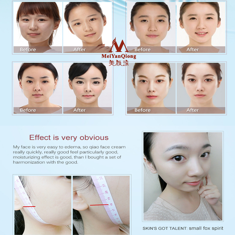 Face Lifting Shaping Skin Care – Luxury Skincare China Bewertung und Preis